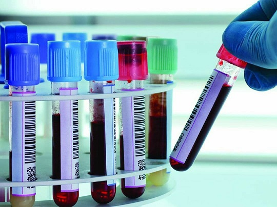 ارائه تخفیفات ویژه به دانشگاهیان در آزمایشگاه فوق‌تخصصی تشخیص طبی مرکز بهداشت و درمان